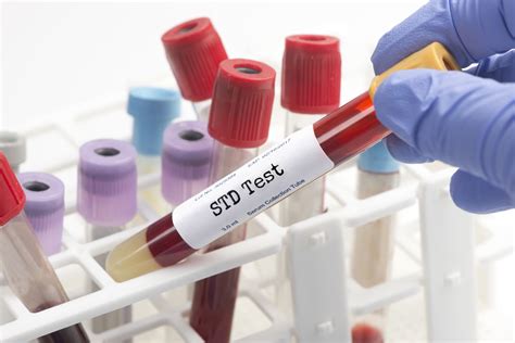 stl testing lab|st louis chemical testing.